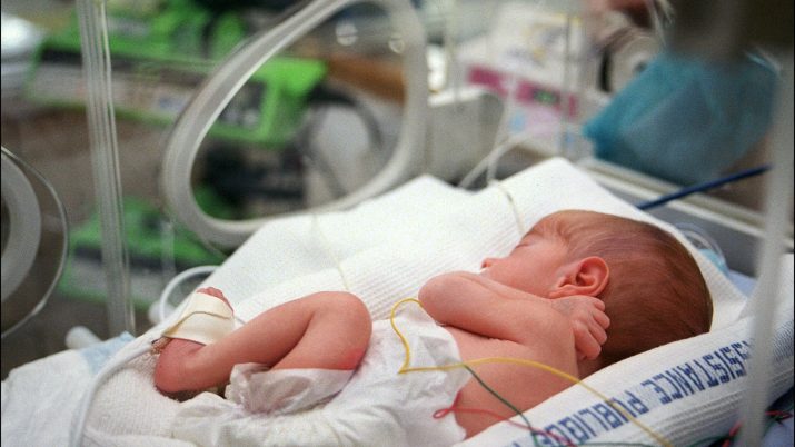 neonato pretermine scaled