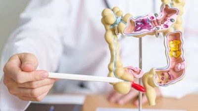 news gennaio 2025 screening colon retto