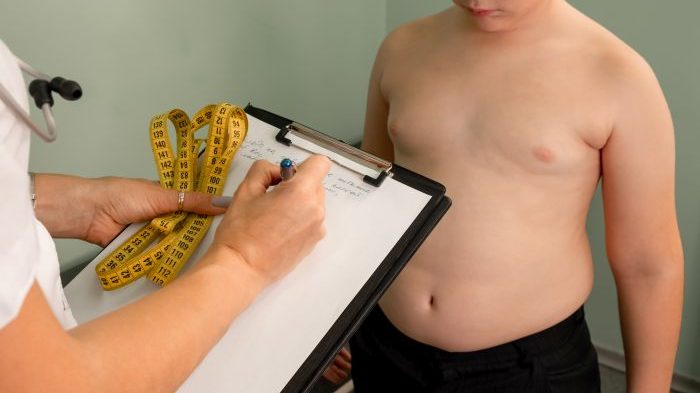obesita infantile