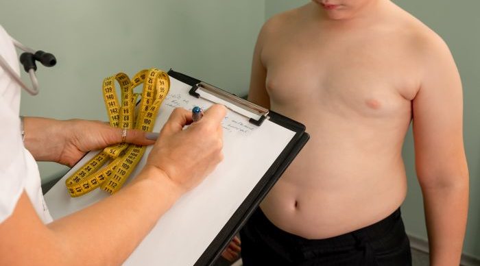 Friendly nutritionist measures waist. Childhood obesity, weight loss. obesita infantile