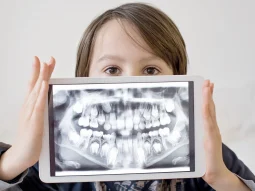 ortopantomografia-bambino-centri-dentistici-primo ortopantomografia bambino centri dentistici primo