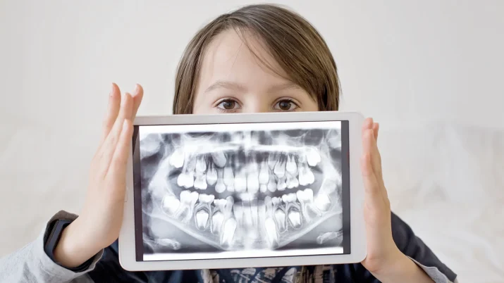 ortopantomografia bambino centri dentistici primo