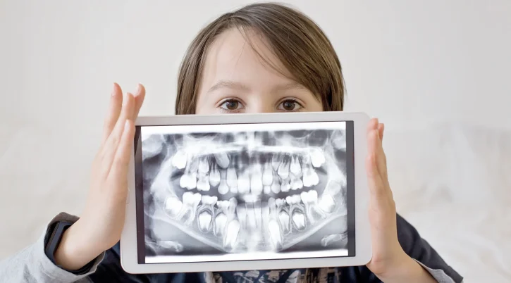 ortopantomografia-bambino-centri-dentistici-primo ortopantomografia bambino centri dentistici primo