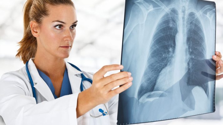 radiografia a domicilio