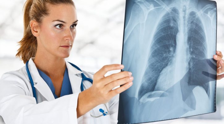 radiografia a domicilio