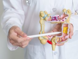 Doctor,Holding,Human,Colon,Anatomy,Model.,Colonic,Disease,,Large,Intestine, shutterstock 2320851747