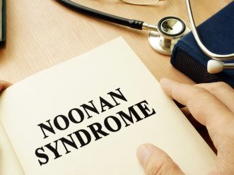 sindrome di noonan