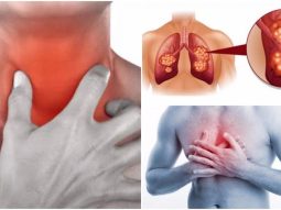 Caffè e farmaci: come evitare interazioni dannose con una semplice strategia mattutina 13 {{brizy_dc_image_alt entityId=