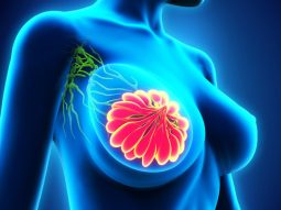 Medicina sportiva: il ruolo strategico del podologo nella prevenzione e nel trattamento degli infortuni 13 {{brizy_dc_image_alt entityId=